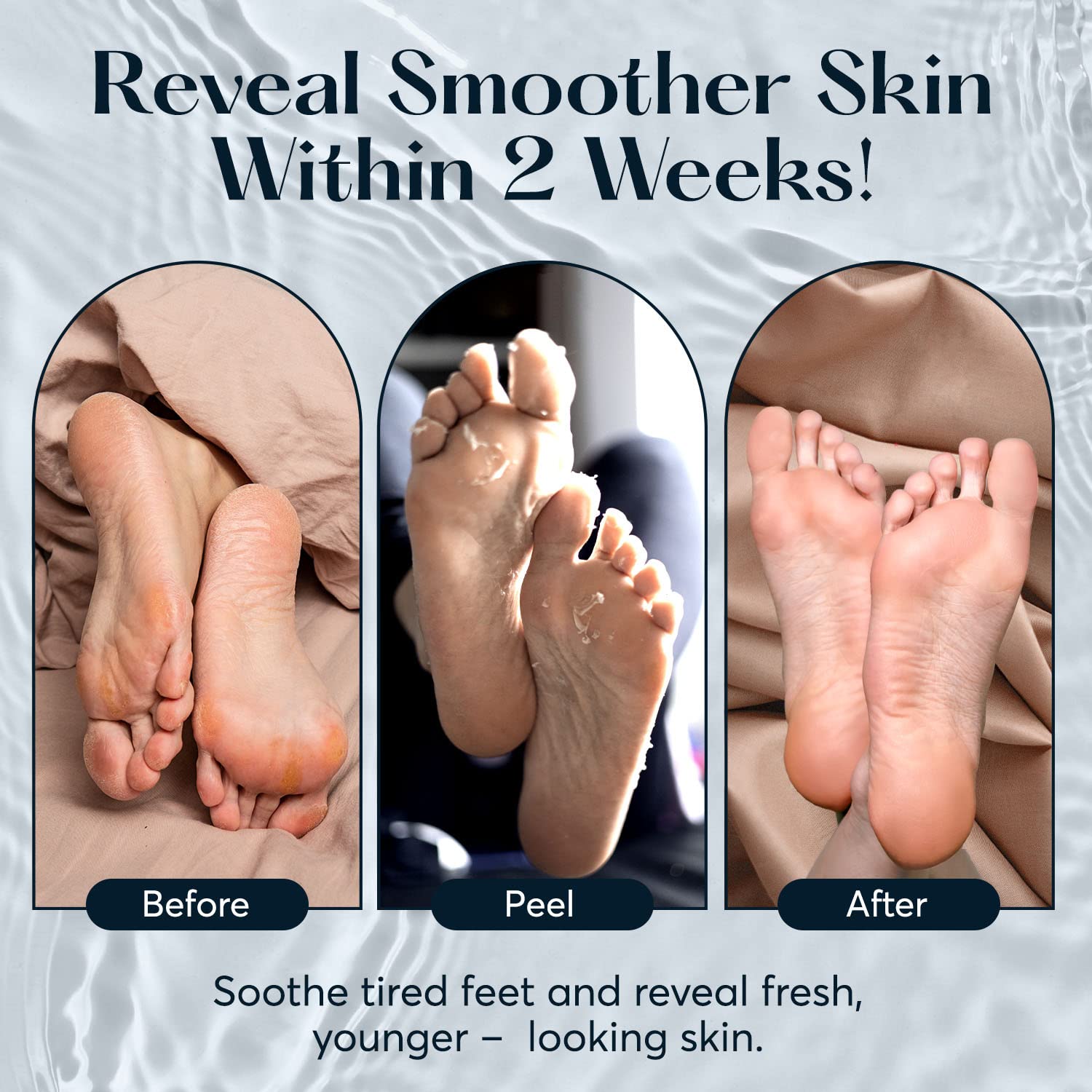 Smoothing Foot Peel